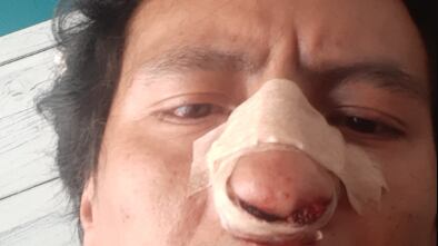 El periodista mencionó que acudió al Ministerio Público con sus heridas como única prueba, situación que resultó inútil, pues la médico legista dijo que no podía certificar sus lesiones.