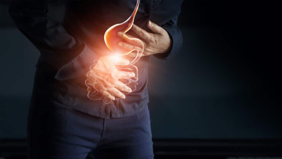 Cáncer de estómago.