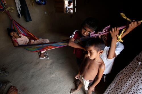 Colombia registra muerte de 308 niños por desnutrición