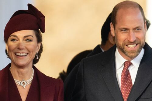 Kate Middleton tendría una cicatriz en la cabeza por una operación realizada en su adolescencia