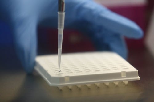 Yucateca da positivo a coronavirus, pero del tipo HKU1