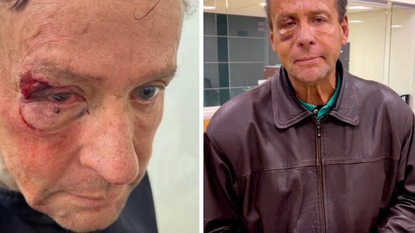 Alfredo Adame operado de emergencia