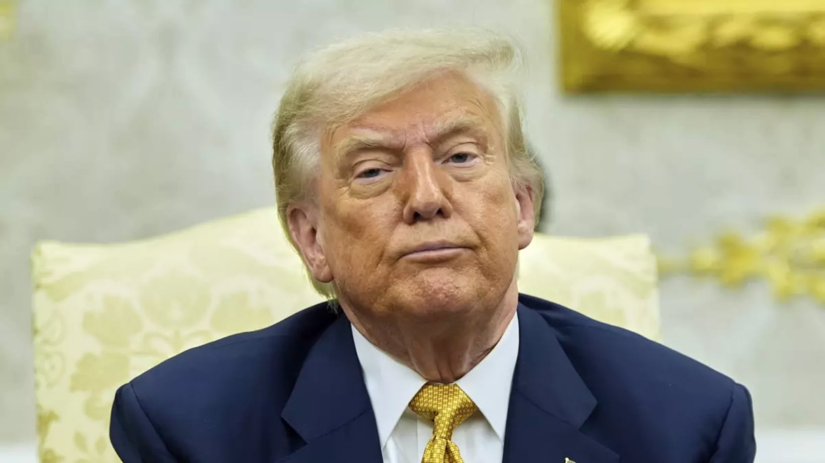 Trump con hinchazón de piernas