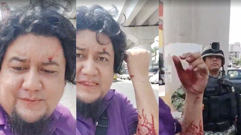 Periodista de Acapulco transmite en vivo agresión en su contra