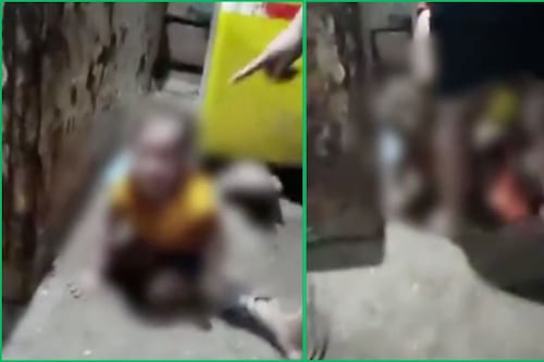 Madre quema y golpea a su hija de 3 años por “berrinchuda”