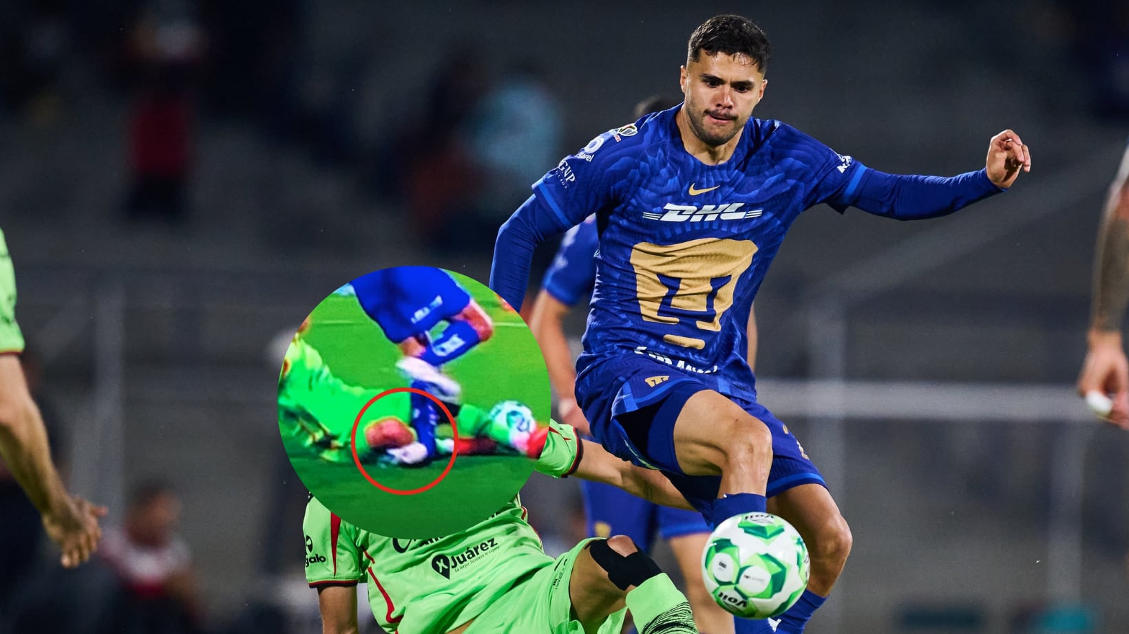 Alan Medina sufrió grave lesión.