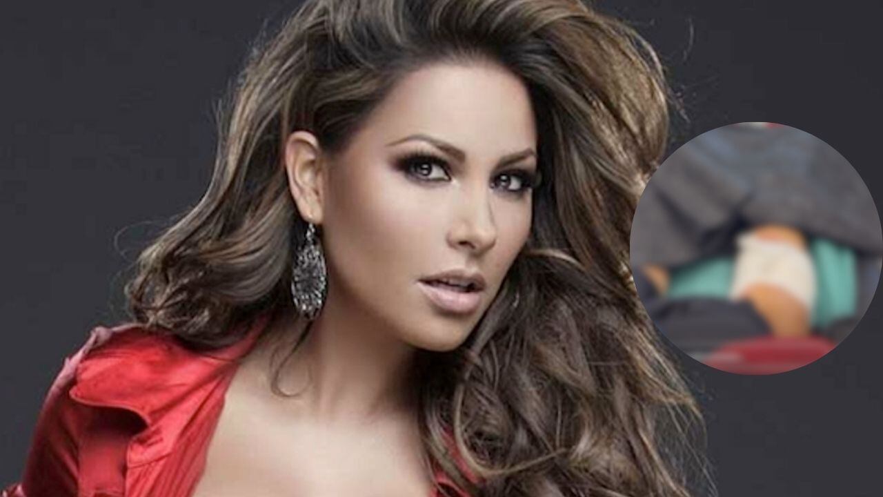 La conductora de Televisa fue gravemente mordida por un