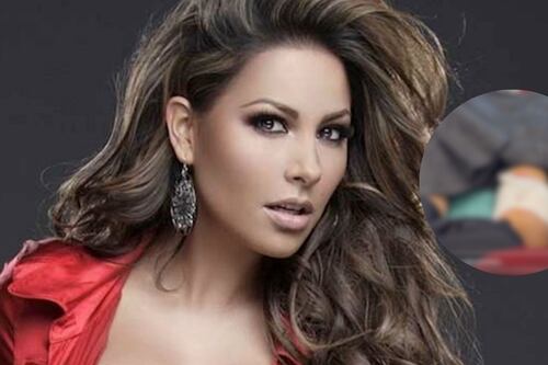 Famosa conductora de Televisa fue mordida por un perro bulldog y le destrozó la pierna; imágenes sensibles