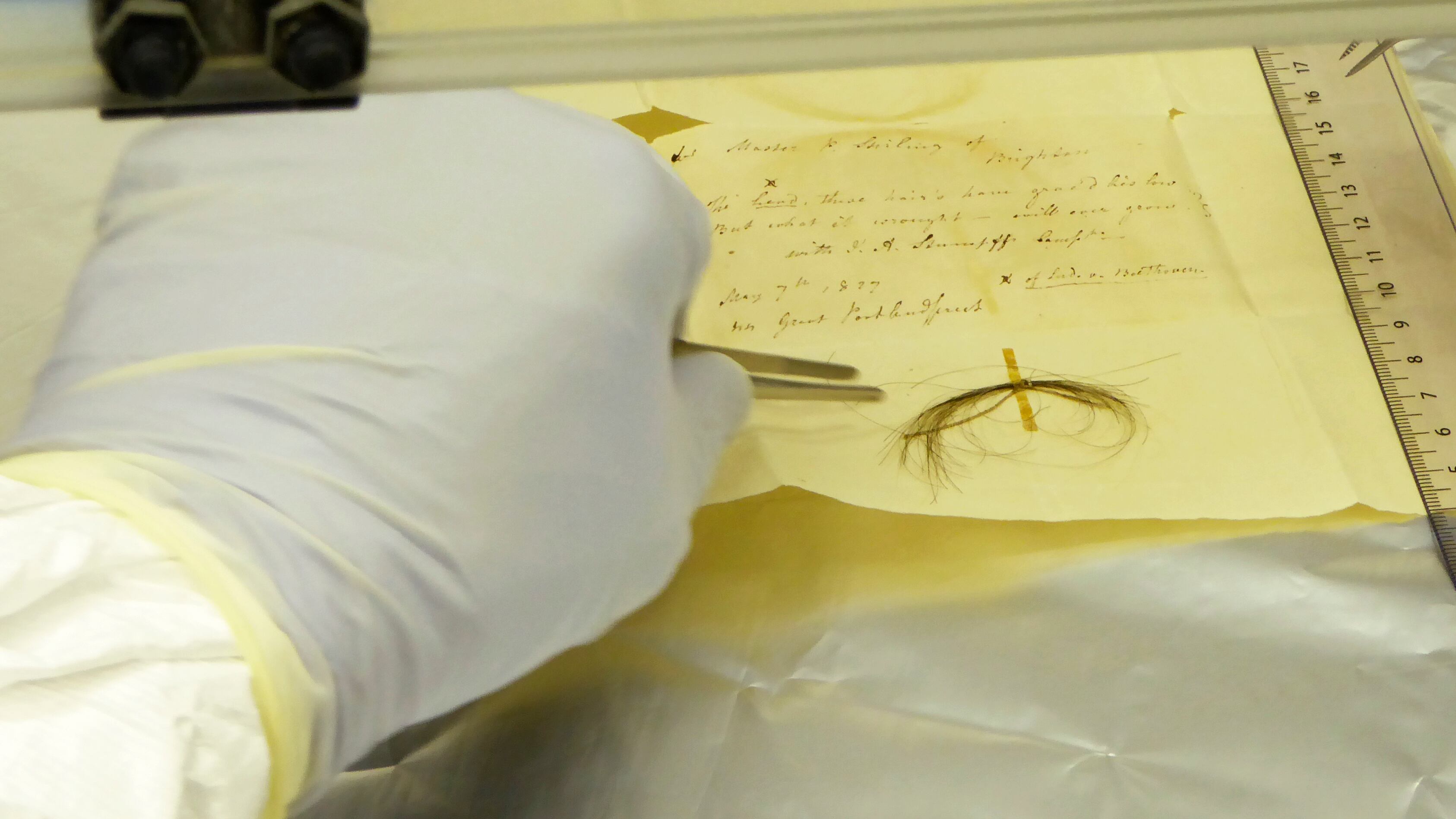 Cabello de Beethoven contiene el ADN que podría determinar con exactitud la causa de su muerte casi 200 años después