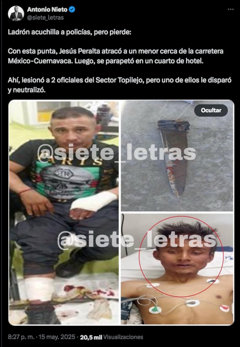 La Secretaría de Seguridad Ciudadana confirmó que el detenido fue hospitalizado bajo custodia