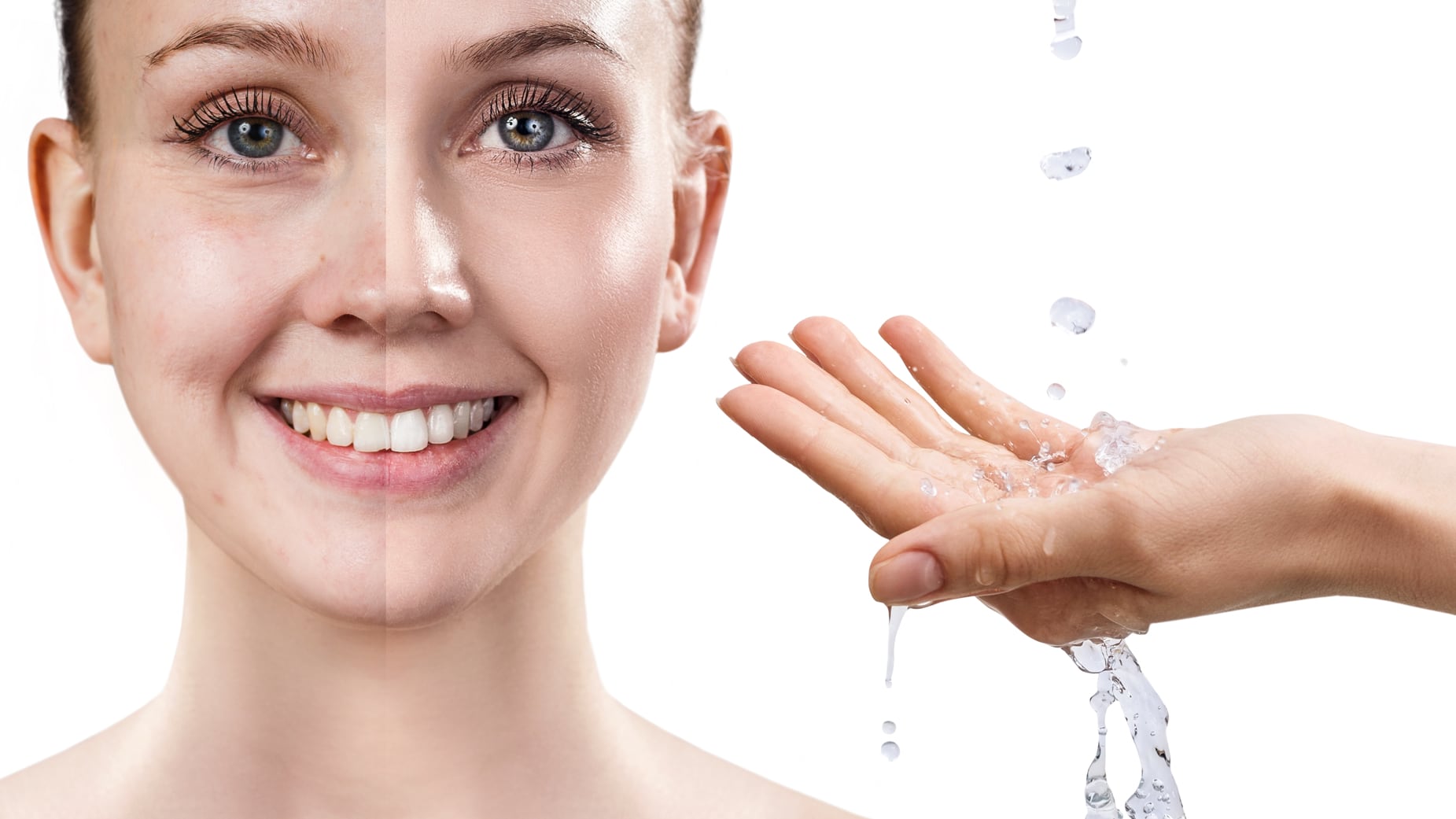 Gracias a la tecnología hoy se pueden hacer procedimientos libre de agujas y así lucir un rostro radiante con menos arrugas y más lifting.