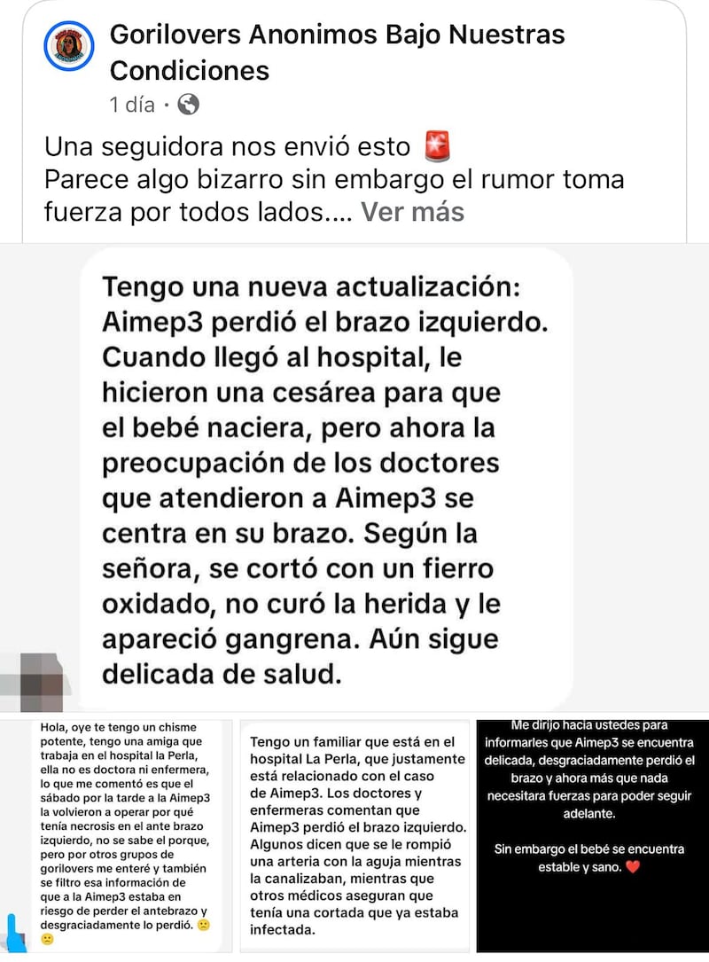 Rumores sobre la pérdida del brazo de AimeP3