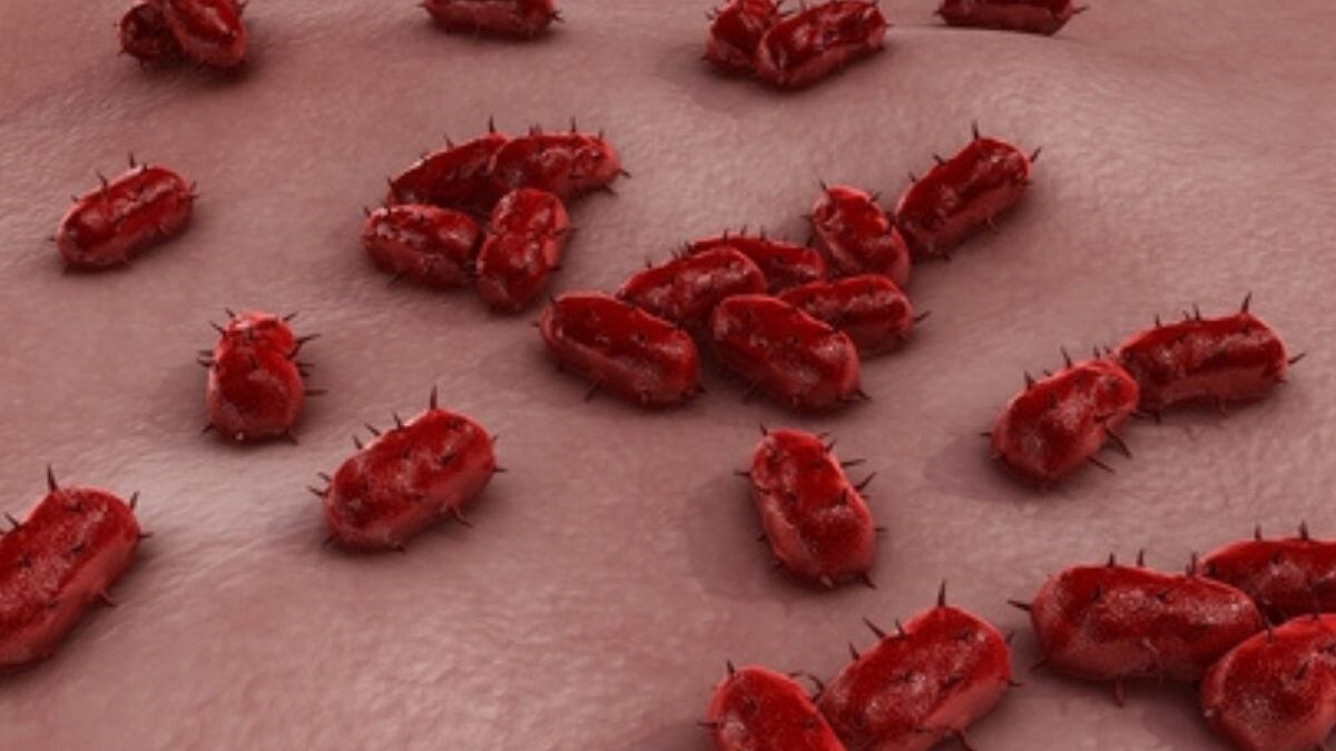 Muertes por brote de Meningitis.