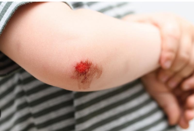 heridas en niños
