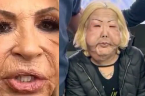 ¿Laura Bozzo se desfiguró el rostro? aparece polémico video en redes sociales de una cirugía fallida