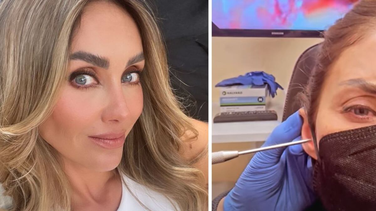 El pasado 20 de junio, Anahí sufrió un accidente que le perforó el tímpano, que puso en duda su llegada al tour de RBD.
