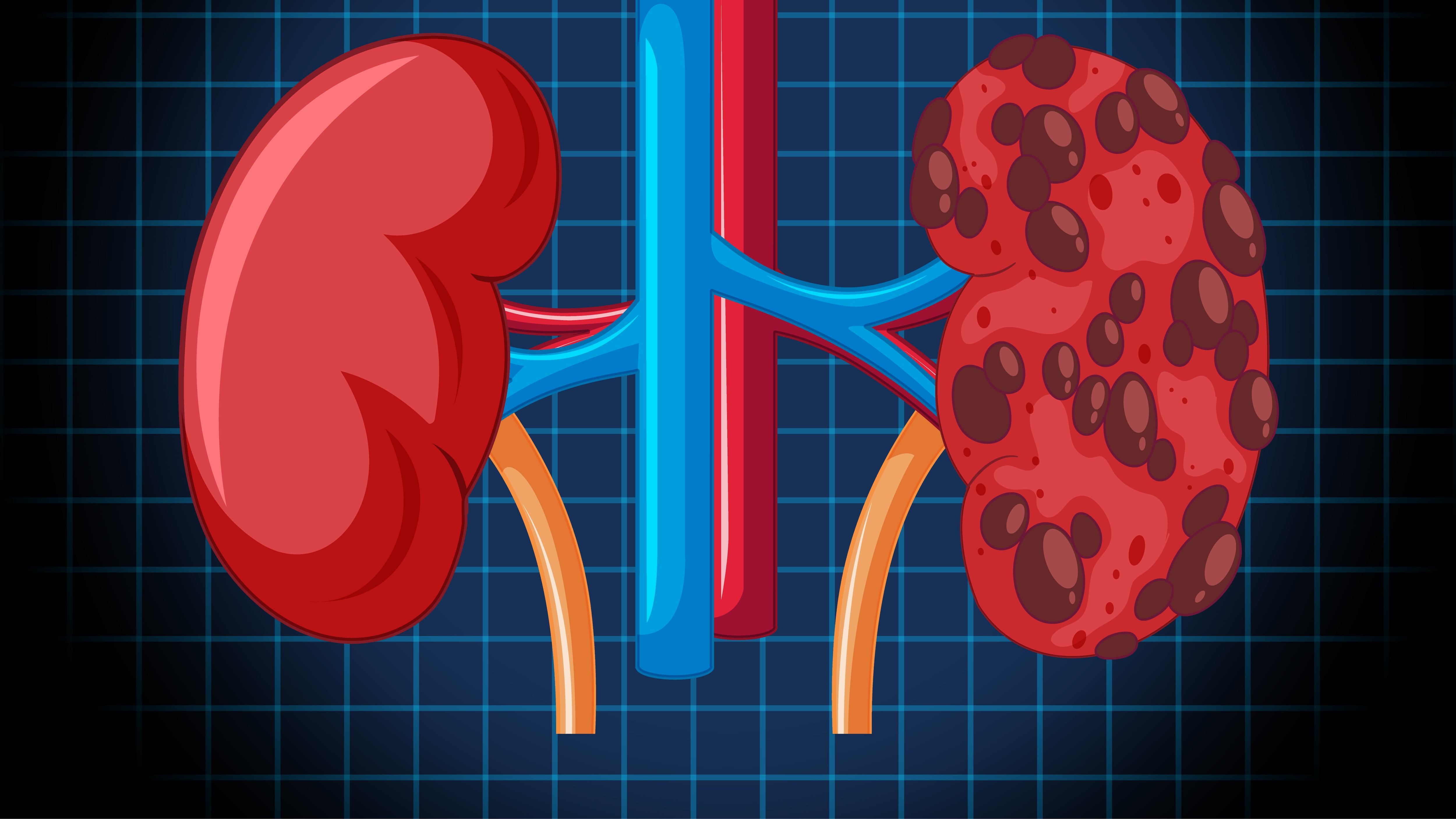 El trabajo principal de los riñones es limpiar la sangre de toxinas y transformar los desechos en orina, pero también realizan otros trabajos importantes como ayudar a controlar la presión arterial y producir glóbulos rojos. Foto: Freepik.