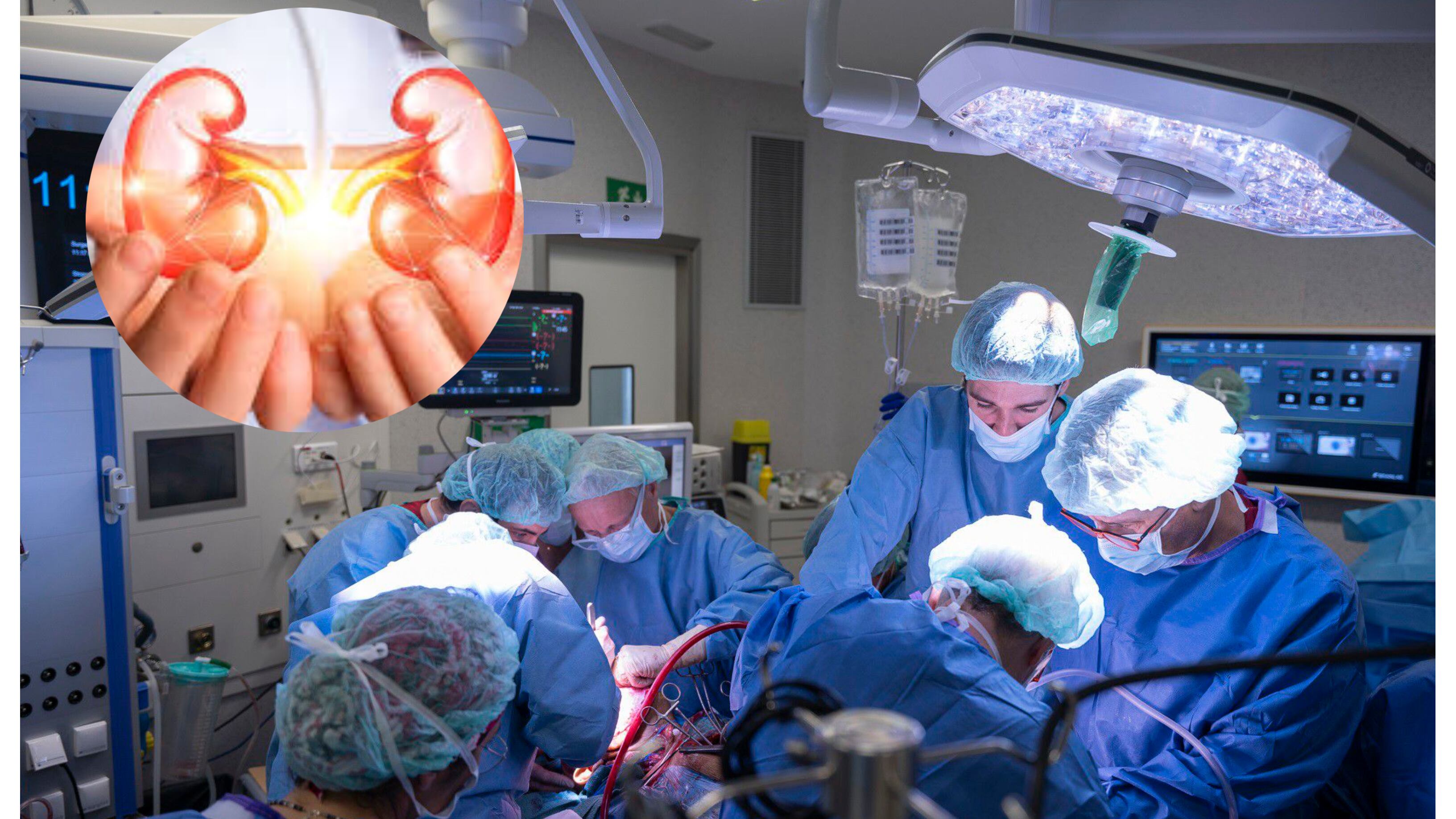 Trasplante de riñón