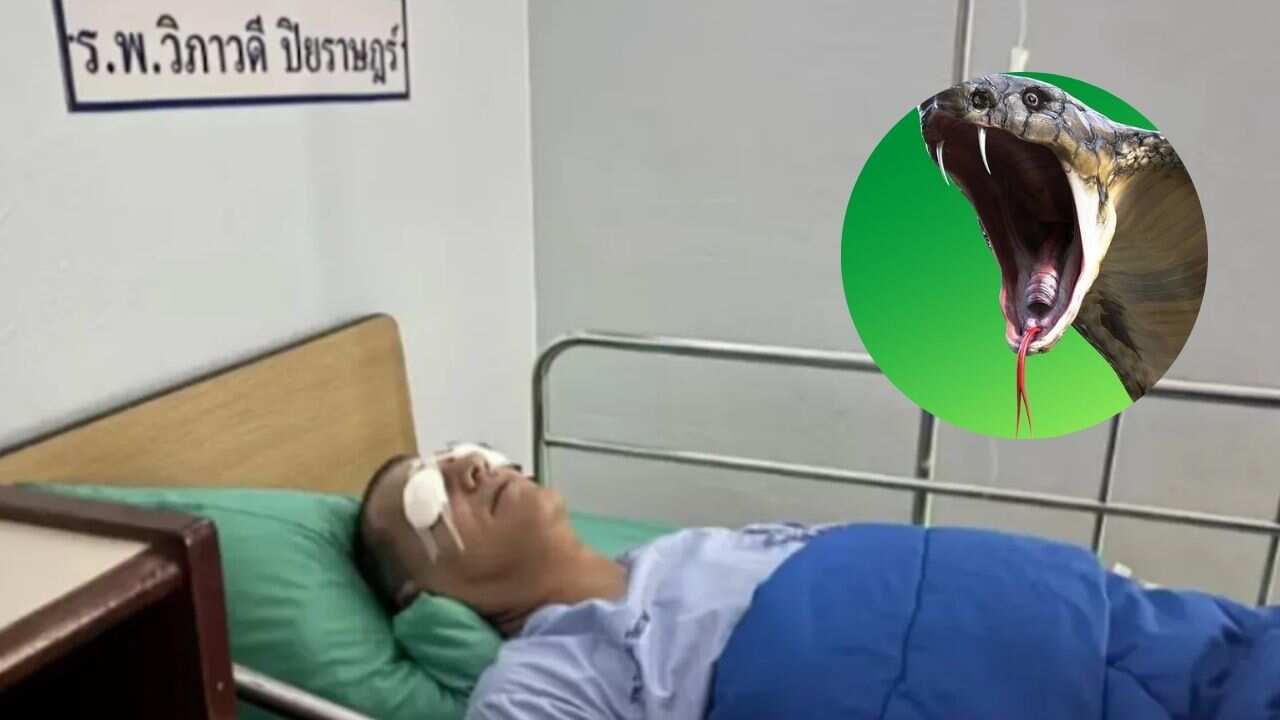 Un influencer fue hospitalizado de emergencia tras haber sido atacado por una cobra.