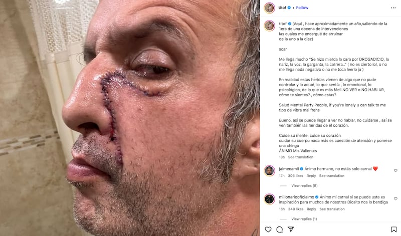 Publicación de Tito Fuentes en Instagram