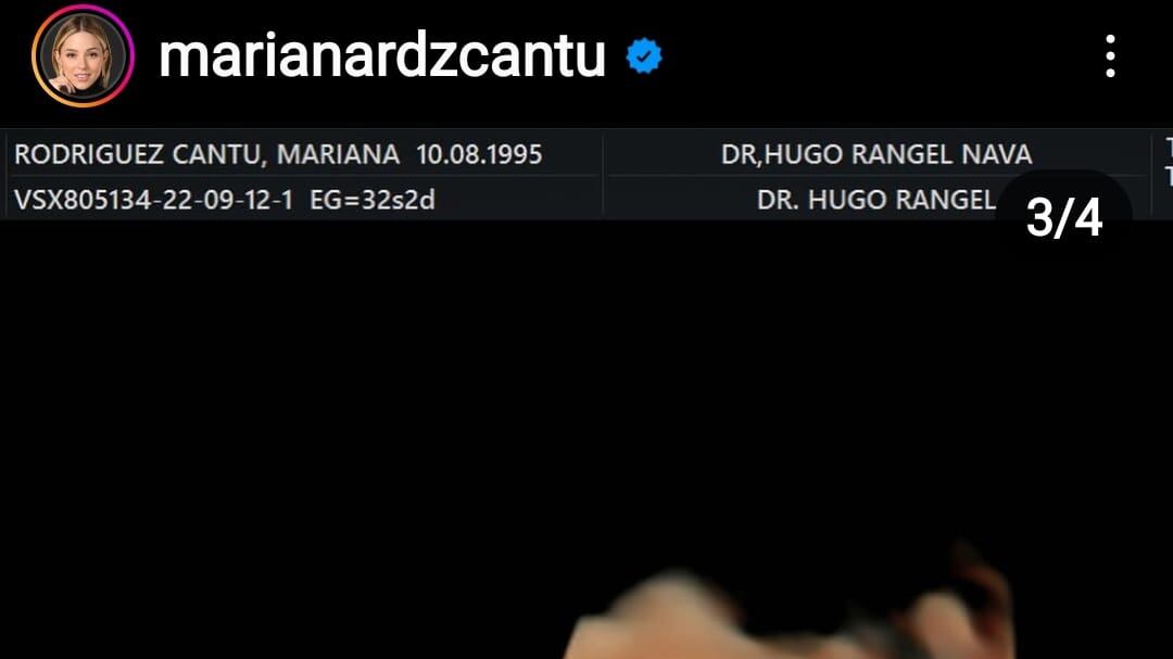 El rostro de la bebé se aprecia perfectamente en tres imágenes que Rodríguez compartió en Instagram.