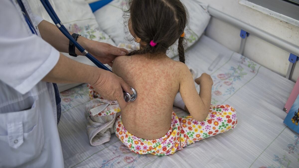 IMAGEN ILUSTRATIVA/ ORGANIZACIÓN MUNDIAL DE LA SALUD (OMS)