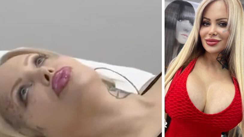 Sabrina Sabrok vuelve a ser virgen gracias a este tratamiento