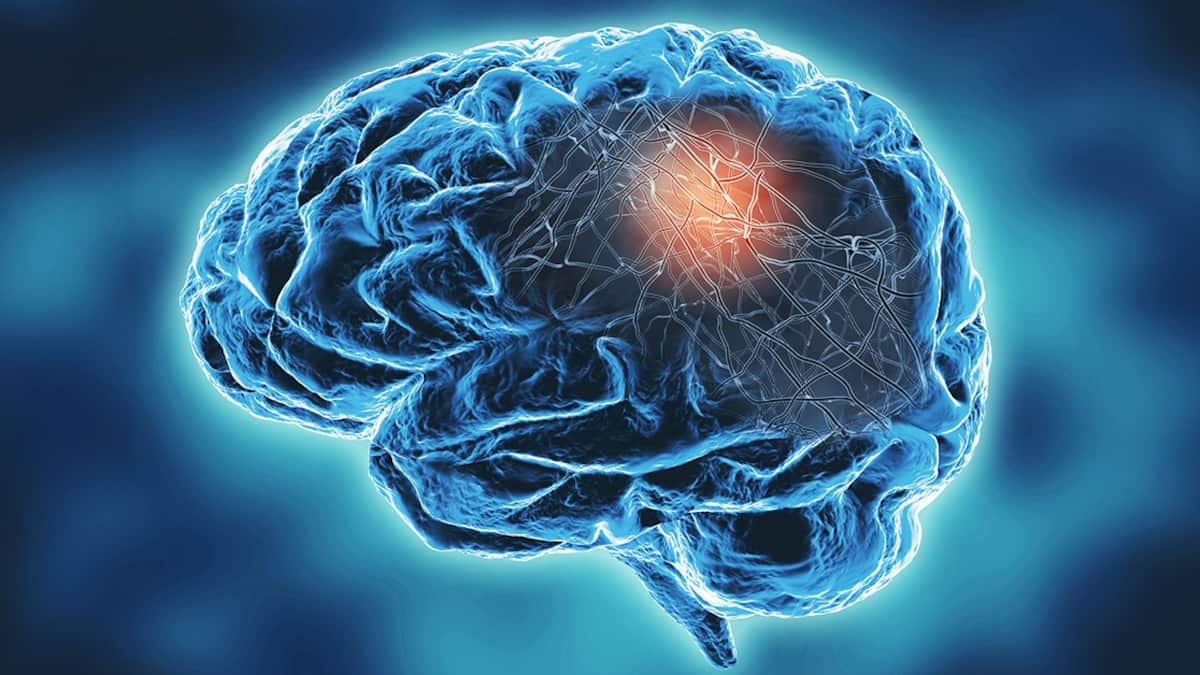 En los primeros ocho meses del año se registraron en Nuevo León 88 nuevos pacientes, lo que representa un incremento del 18.9% respecto a 2024.