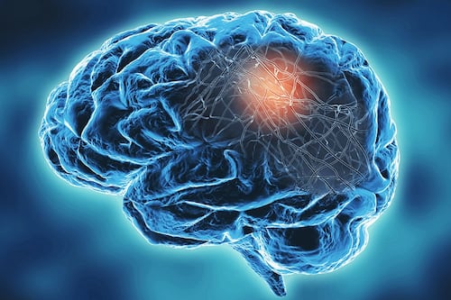 Hay tantos enfermos de Alzheimer en NL que se llenarían el Estadio de Tigres o el BBVA