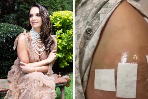 Lupita Jones se sometió a una cirugía debido al exceso de ejercicio