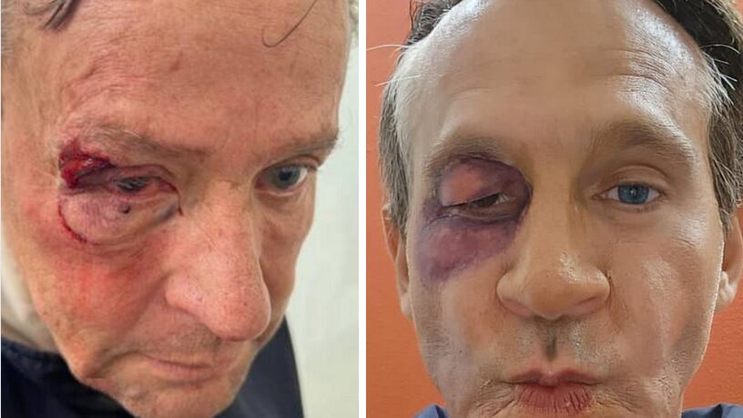 Arath de la Torre parodia golpe en el ojo de Alfredo Adame