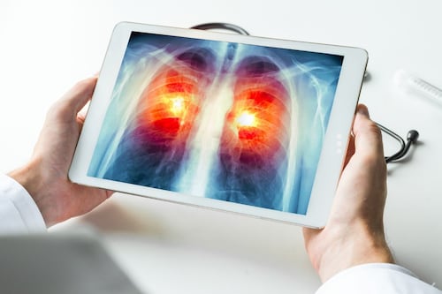 Nueva esperanza para pacientes con cáncer de pulmón: FDA aprueba tratamiento oral innovador