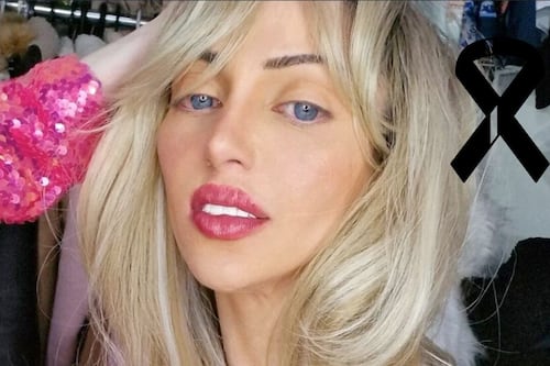 Encuentran muerta a influencer conocida como la ‘Barbie Humana’; tenía lesiones y marcas en la espalda