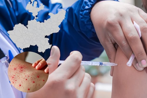 Con 276 casos, Tlaquepaque es el municipio con más casos de sarampión