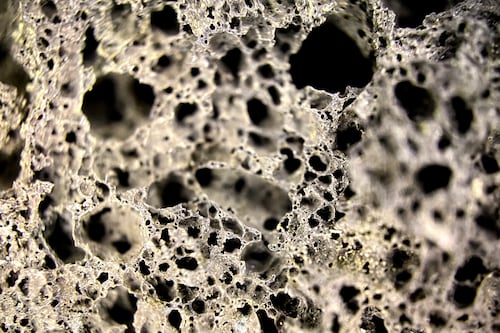 Osteoporosis: la enfermedad silenciosa que causa 70 fracturas por minuto en el mundo