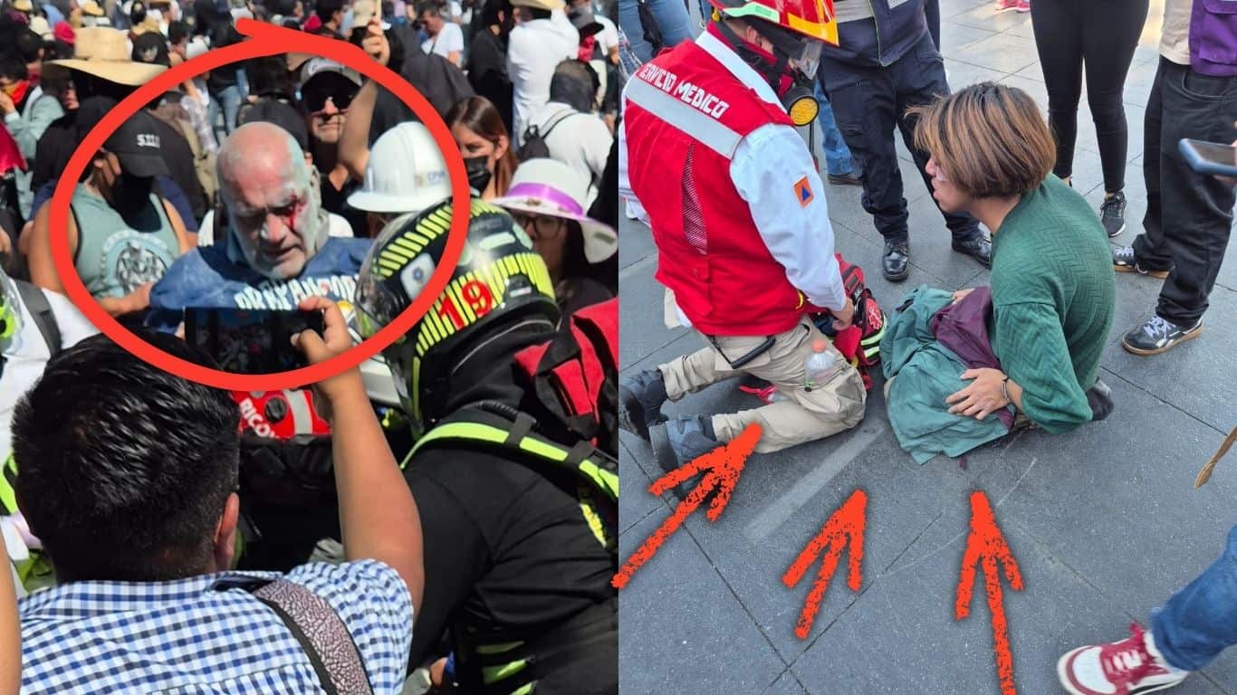 Herido en la marcha de la Generación Z