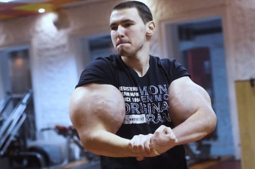 Famoso influencer conocido como ‘Popeye Ruso’ podría perder los brazos tras terrible infección