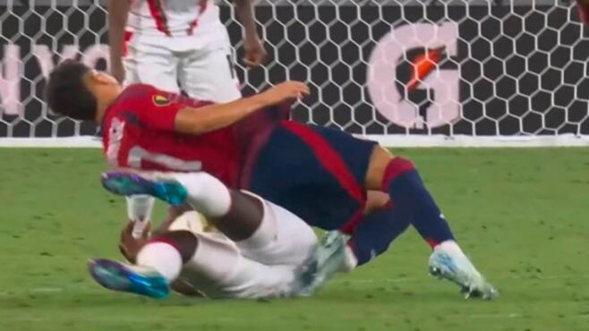 Warren Madrigal sufrió desgarradora lesión en la Copa Oro.