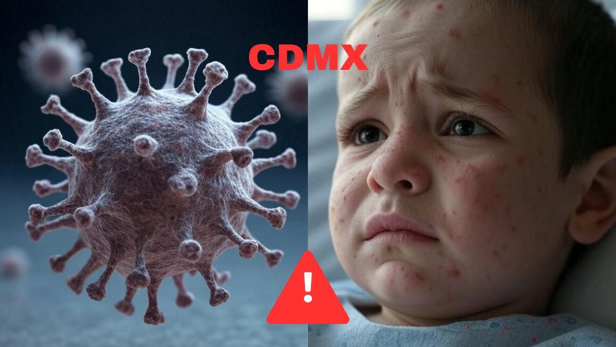 Sarampión: ¿CDMX al borde de una epidemia?; alcaldías con casos confirmados y dónde hay vacuna gratis