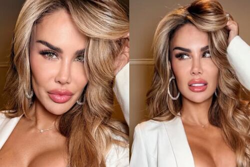 Ninel Conde cambia el color de sus ojos en una costosa cirugía: ¿Cuánto pagó?