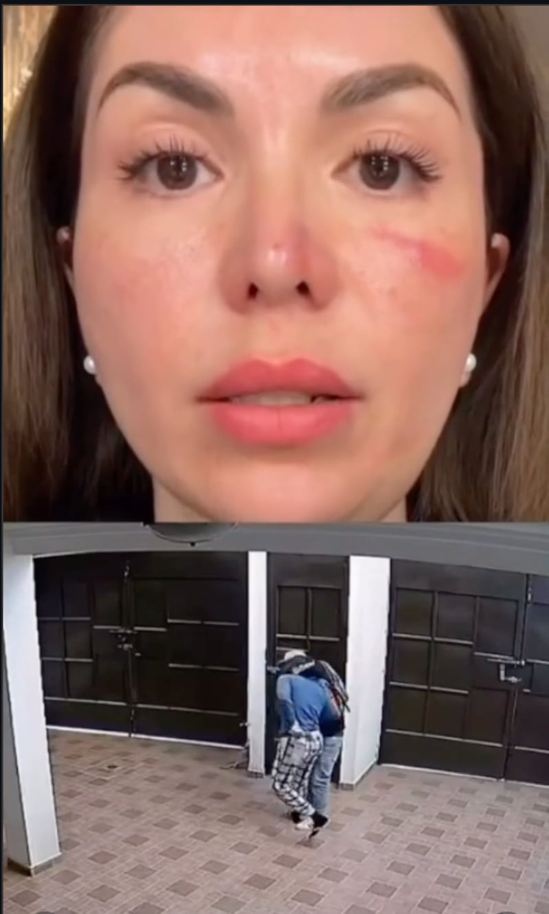 Mujer es asaltada en su casa