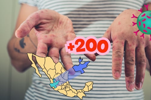 Con 208 casos de sarampión, la SSJ refuerza vigilancia en Arandas al concentrar 139 contagios