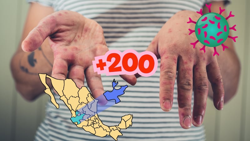 Sarampión en México no es por falta de vacunas: “es un fenómeno mundial”, dice Salud