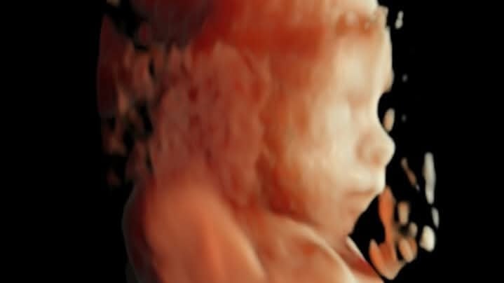 Ya se aprecia perfectamente el rostro de la bebé.