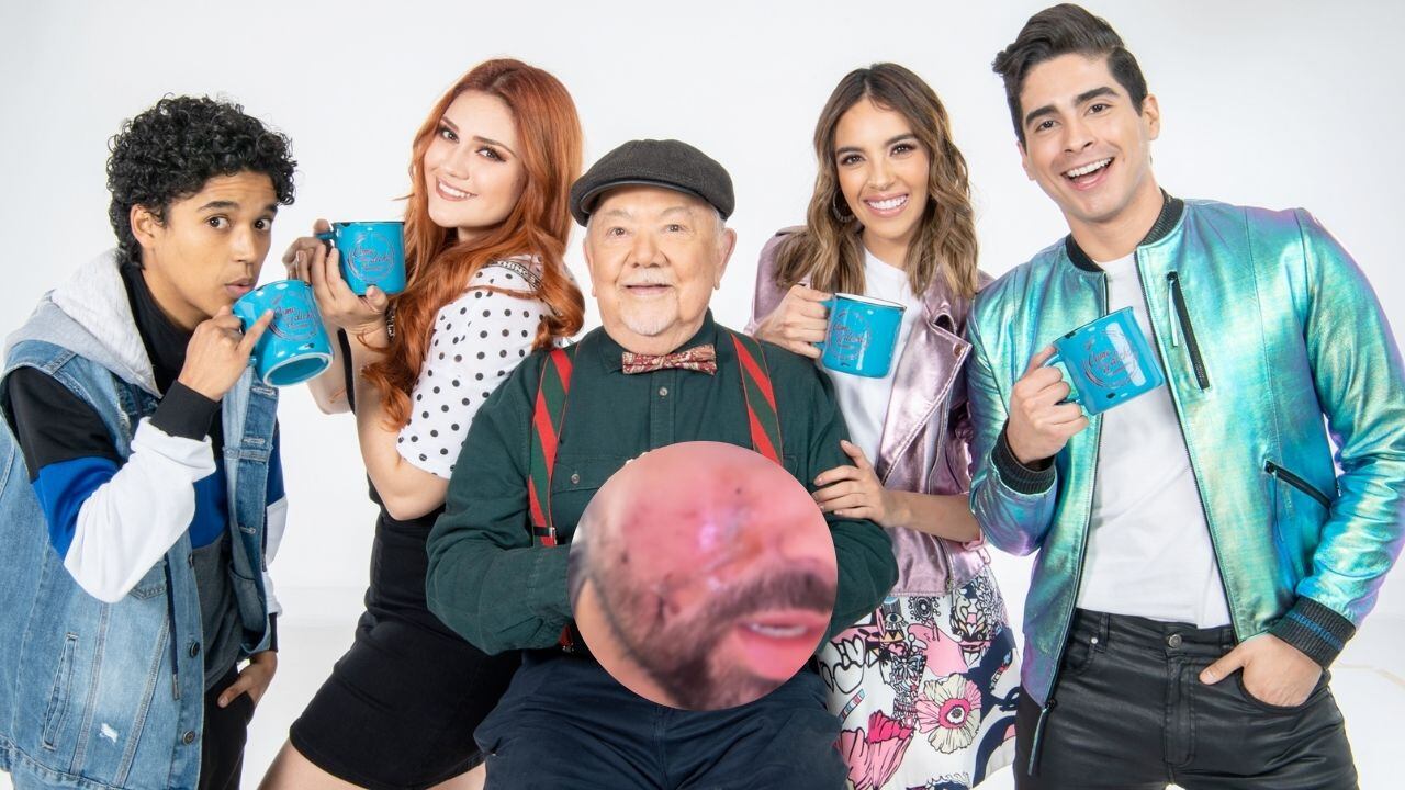 Un actor de 'Como dice el dicho' mostró en redes sociales el terrible ataque que sufrió.