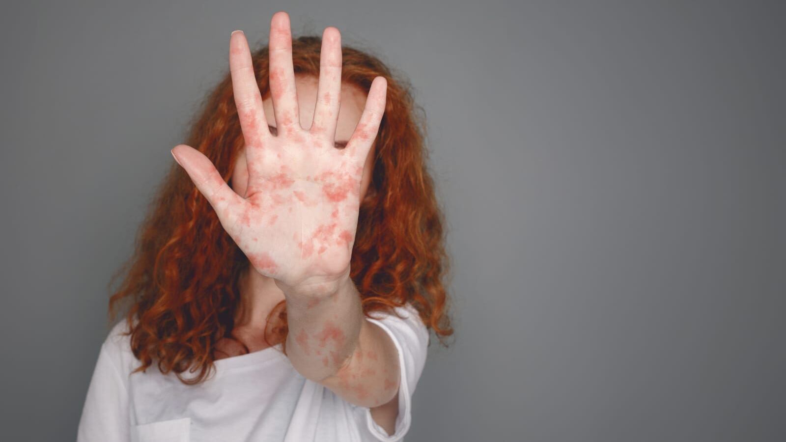 Por la pandemia de covid19 se dejaron de aplicar alrededor de 60 millones de vacunas en el mundo,