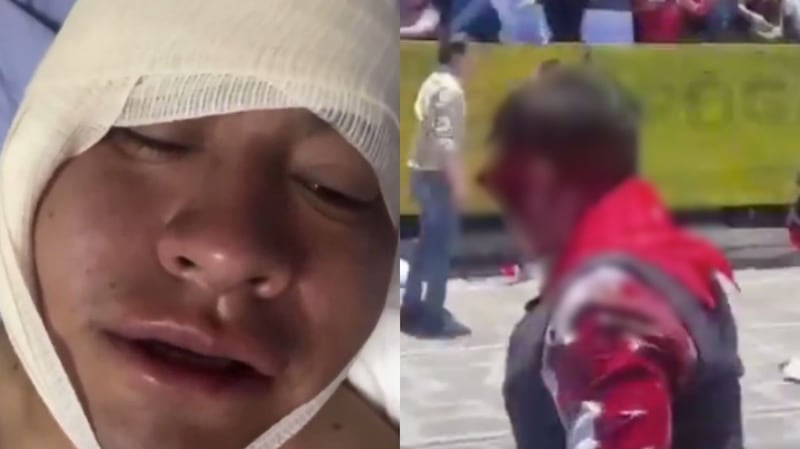 Así quedó el cachete del torero