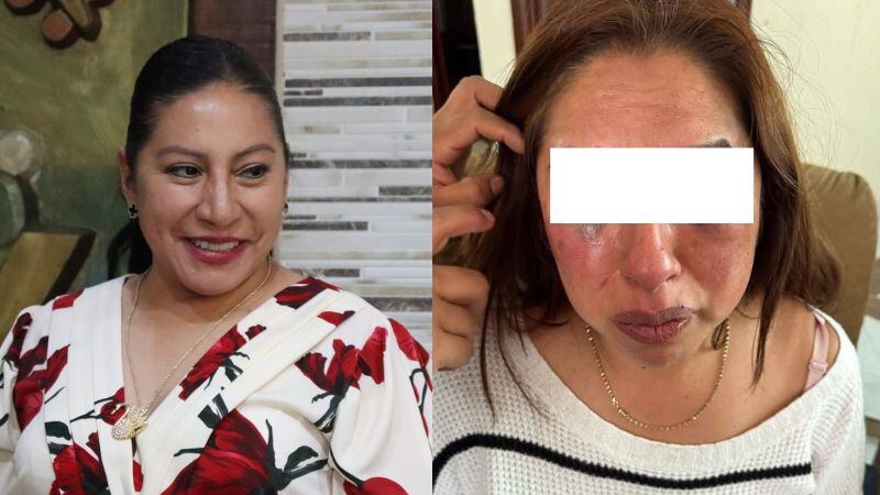 Selenne Hernández, alcaldesa de Capulhuac, golpea a psicóloga en el DIF