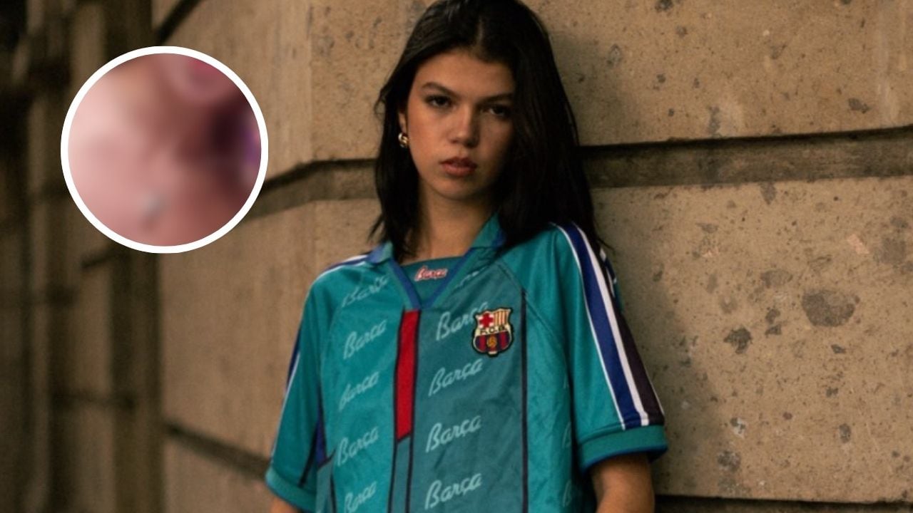 Valentina Gilabert muestra sus cicatrices