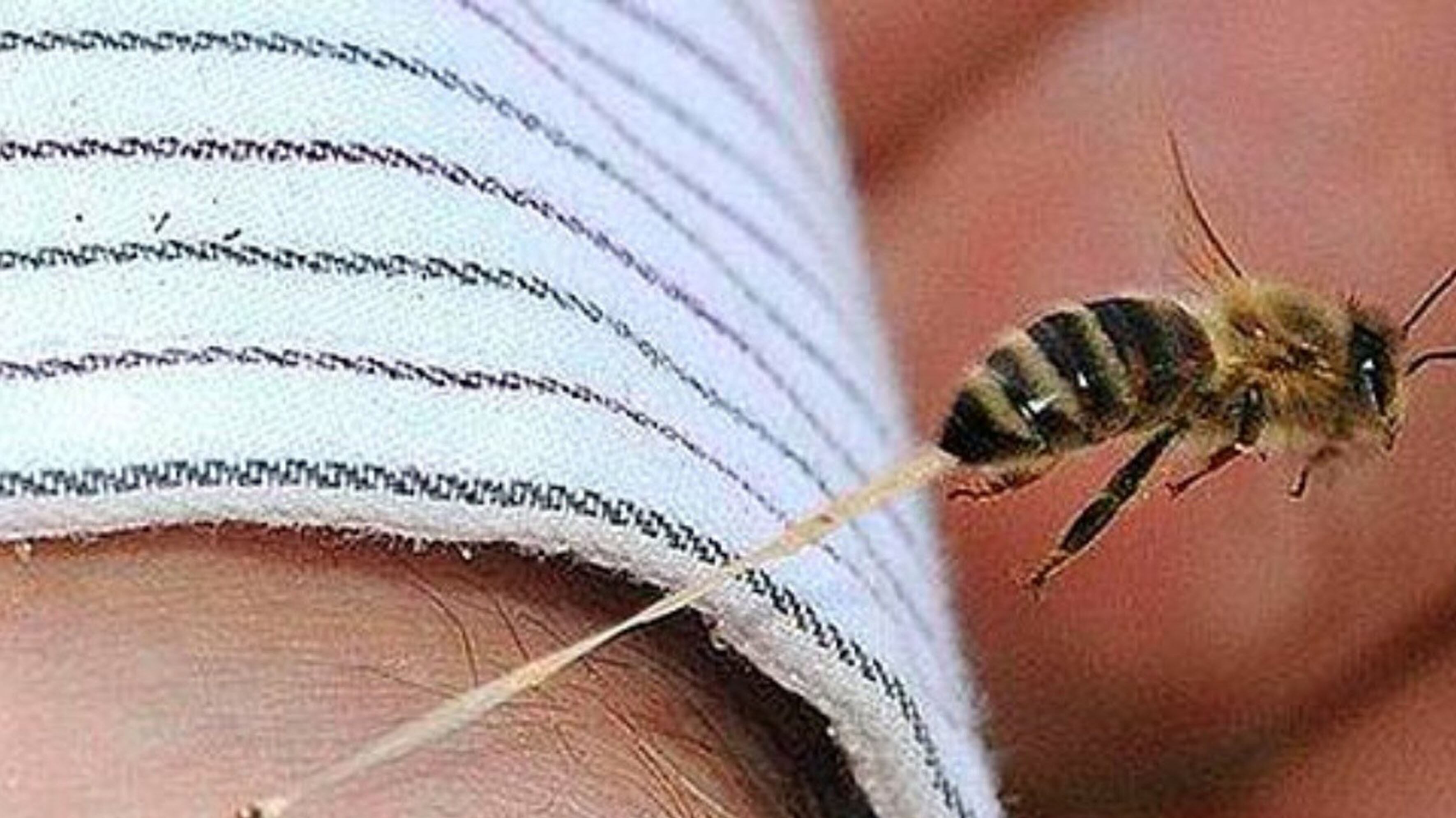 Picaduras de abeja UNAM